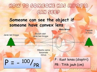 Someone can see the object if
someone have convex lens

P=-

100/
PR

P : Kuat lensa (dioptri)

PR : Titik jauh (cm)

 