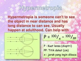 P = 100/x – 100/PP
P : Kuat lensa (dioptri)

PP: Titik dekat (cm)
x : jarak yang ingin dibaca

 