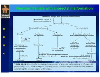Newborn Female with anorectal malformation 
M 
M 
M 
C 
 