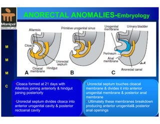 ANORECTAL ANOMALIES-Embryology 
M 
M 
M 
C 
•Cloaca formed at 21 days with 
Allantois joining anteriorly & hindgut 
joining posteriorly 
•Urorectal septum divides cloaca into 
anterior urogenital cavity & posterior 
rectoanal cavity 
•Urorectal septum touches cloacal 
membrane & divides it into anterior 
urogenital membrane & posterior anal 
membrane 
• Ultimately these membranes breakdown 
producing anterior urogenital& posterior 
anal openings 
 