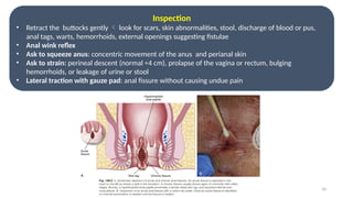 Benign anorectal disorders: Hemorrhoids, anal fissure, SRUS, Perianal