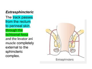 ANORECTAL DISORDERS.FOR ALL MEDICAL STUDENTS | PPTX