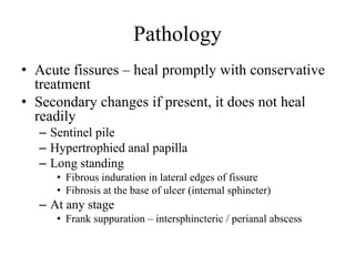 Pathology
• Acute fissures – heal promptly with conservative
treatment
• Secondary changes if present, it does not heal
readily
– Sentinel pile
– Hypertrophied anal papilla
– Long standing
• Fibrous induration in lateral edges of fissure
• Fibrosis at the base of ulcer (internal sphincter)
– At any stage
• Frank suppuration – intersphincteric / perianal abscess
 