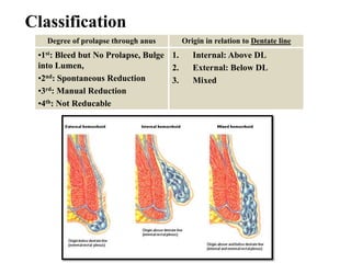 Classification
Degree of prolapse through anus Origin in relation to Dentate line
•1st: Bleed but No Prolapse, Bulge
into Lumen,
•2nd: Spontaneous Reduction
•3rd: Manual Reduction
•4th: Not Reducable
1. Internal: Above DL
2. External: Below DL
3. Mixed
 