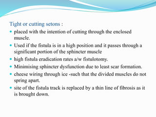 Tight or cutting setons :
 placed with the intention of cutting through the enclosed
muscle.
 Used if the fistula is in a high position and it passes through a
significant portion of the sphincter muscle
 high fistula eradication rates a/w fistulotomy.
 Minimising sphincter dysfunction due to least scar formation.
 cheese wiring through ice -such that the divided muscles do not
spring apart.
 site of the fistula track is replaced by a thin line of fibrosis as it
is brought down.
 