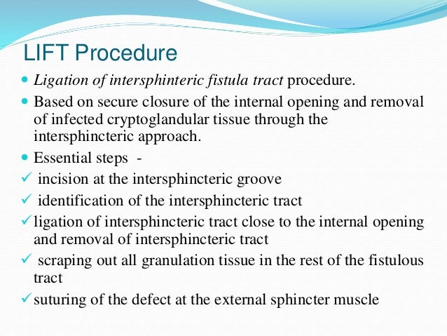 Anorectal Fistula Anorectal Fistula
