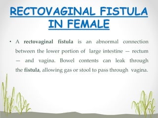 RECTOVAGINAL FISTULA
IN FEMALE
• A rectovaginal fistula is an abnormal connection
between the lower portion of large intestine — rectum
— and vagina. Bowel contents can leak through
the fistula, allowing gas or stool to pass through vagina.
 