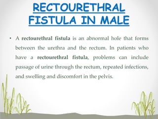 RECTOURETHRAL
FISTULA IN MALE
• A rectourethral fistula is an abnormal hole that forms
between the urethra and the rectum. In patients who
have a rectourethral fistula, problems can include
passage of urine through the rectum, repeated infections,
and swelling and discomfort in the pelvis.
 