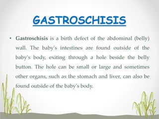 GASTROSCHISIS
• Gastroschisis is a birth defect of the abdominal (belly)
wall. The baby's intestines are found outside of the
baby's body, exiting through a hole beside the belly
button. The hole can be small or large and sometimes
other organs, such as the stomach and liver, can also be
found outside of the baby's body.
 