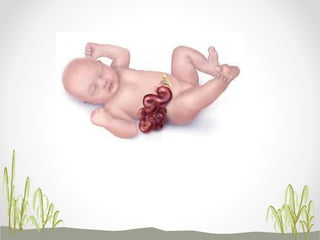 Anorectal malformation