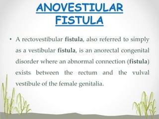 ANOVESTIULAR
FISTULA
• A rectovestibular fistula, also referred to simply
as a vestibular fistula, is an anorectal congenital
disorder where an abnormal connection (fistula)
exists between the rectum and the vulval
vestibule of the female genitalia.
 