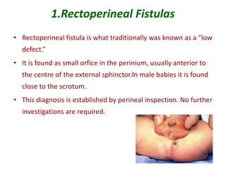 1.Rectoperineal Fistulas
• Rectoperineal fistula is what traditionally was known as a “low
defect.”
• It is found as small orfice in the perinium, usually anterior to
the centre of the external sphinctor.In male babies it is found
close to the scrotum.
• This diagnosis is established by perineal inspection. No further
investigations are required.
 