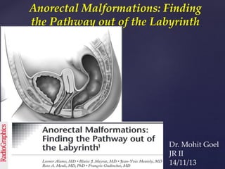 Anorectal Malformations: Finding
the Pathway out of the Labyrinth
Dr. Mohit Goel
JR II
14/11/13
 
