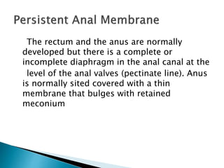 The rectum and the anus are normally
developed but there is a complete or
incomplete diaphragm in the anal canal at the
level of the anal valves (pectinate line). Anus
is normally sited covered with a thin
membrane that bulges with retained
meconium
 