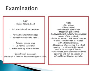  Low
• Bucket handle defect
• Gas/meconium from perineum
• Perineal fistula if skin bridge
 between vestibule and fistula.
• Anterior ectopic anus
 i.e. normal sized anus
 surrounded by normal muscle.
• Urine free of meconium
 (NB average of 20 hrs for meconium to appear in urine).
High
•Flat bottom
•Short sacrum
•Little muscle contraction
•Meconium per urethra
•Rectovestibular fistula if within mucosal
margin of the vestibule.
•Sphincter located close to the scrotum
or bifid scrotum often associated
with a Prostatic Fistula.
•Cloacae are often missed if urethral
opening is not identified in female
with a “recto-vaginal” fistula.
•Furthermore, cloacae often have small
openings and may be a cause of
referral for ambiguous genitalia.
 