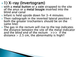  1) X-ray (Invertogram)
 with a metal button or a coin strapped to the site
of the anus or a metal bougie inserted into the
blind anal canal
 Infant is held upside down for 3-4 minutes
 Then radiograph in the inverted lateral position (
both the greater trochanters should be on the
same line)
 The gas in the rectum will rise to the top indicates
the distance between the site of the metal indicator
and the blind end of the rectum >>> if the
distance > 2.5 cm, the abnormality is high!!
 