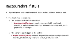 Rectourethral fistula
 Imperforate anus with a rectourethral fistula is most common defect in boys.
 The fistula may be located at
o The lower (bulbar) part of the urethra
• Lower urethral fistulas are usually associated with good-quality
muscles, a well-developed sacrum, a prominent midline groove, and a
prominent anal dimple.
o The higher (prostatic) part of the urethra
• Higher urethral fistulas are more frequently associated with poor-quality
muscles, an abnormally developed sacrum, a flat perineum.
 