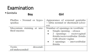 Examination
 Genitalia
Boy Girl
 