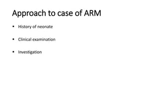 Approach to case of ARM
 History of neonate
 Clinical examination
 Investigation
 