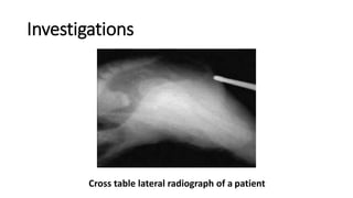 Investigations
Cross table lateral radiograph of a patient
 