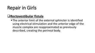 Repair in Girls
Rectovestibular fistula
The anterior limit of the external sphincter is identified
using electrical stimulation and the anterior edge of the
muscle complex are reapproximated as previously
described, creating the perineal body.
 