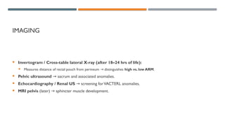 Comprehensive Overview of Anorectal Malformations in Pediatric Surgery ...