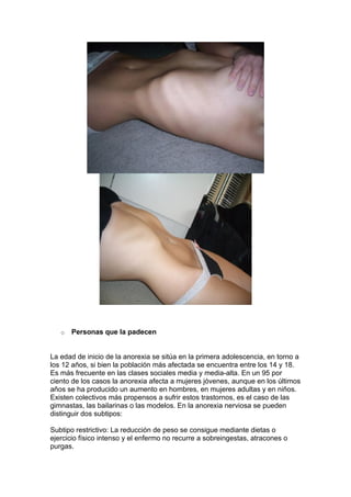 o   Personas que la padecen


La edad de inicio de la anorexia se sitúa en la primera adolescencia, en torno a
los 12 años, si bien la población más afectada se encuentra entre los 14 y 18.
Es más frecuente en las clases sociales media y media-alta. En un 95 por
ciento de los casos la anorexia afecta a mujeres jóvenes, aunque en los últimos
años se ha producido un aumento en hombres, en mujeres adultas y en niños.
Existen colectivos más propensos a sufrir estos trastornos, es el caso de las
gimnastas, las bailarinas o las modelos. En la anorexia nerviosa se pueden
distinguir dos subtipos:

Subtipo restrictivo: La reducción de peso se consigue mediante dietas o
ejercicio físico intenso y el enfermo no recurre a sobreingestas, atracones o
purgas.
 