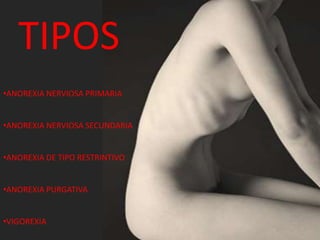 TIPOS
•ANOREXIA NERVIOSA PRIMARIA
•ANOREXIA NERVIOSA SECUNDARIA
•ANOREXIA DE TIPO RESTRINTIVO
•ANOREXIA PURGATIVA
•VIGOREXIA
 