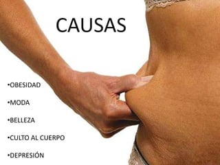CAUSAS
CAUSAS
•OBESIDAD
•MODA
•BELLEZA
•CULTO AL CUERPO
•DEPRESIÓN
 