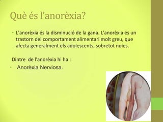 Què és l’anorèxia?
• L'anorèxia és la disminució de la gana. L'anorèxia és un
  trastorn del comportament alimentari molt greu, que
  afecta generalment els adolescents, sobretot noies.

 Dintre de l'anorèxia hi ha :
• Anorèxia Nerviosa.
 