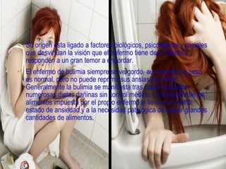 CAUSAS

• Su origen esta ligado a factores biológicos, psicológicos y sociales
  que desvirtúan la visión que el enfermo tiene de sí mismo y
  responden a un gran temor a engordar.
• El enfermo de bulimia siempre se ve gordo, aun cuando su peso
  es normal, pero no puede reprimir sus ansias de comer.
  Generalmente la bulimia se manifiesta tras haber realizado
  numerosas dietas dañinas sin control médico. La limitación de los
  alimentos impuesta por el propio enfermo le lleva a un fuerte
  estado de ansiedad y a la necesidad patológica de ingerir grandes
  cantidades de alimentos.
 