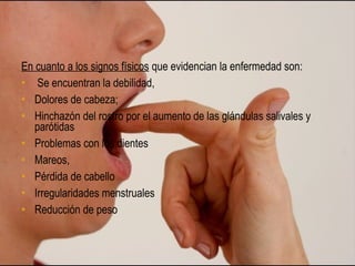 En cuanto a los signos físicos que evidencian la enfermedad son:
• Se encuentran la debilidad,
• Dolores de cabeza;
• Hinchazón del rostro por el aumento de las glándulas salivales y
   parótidas
• Problemas con los dientes
• Mareos,
• Pérdida de cabello
• Irregularidades menstruales
• Reducción de peso
 