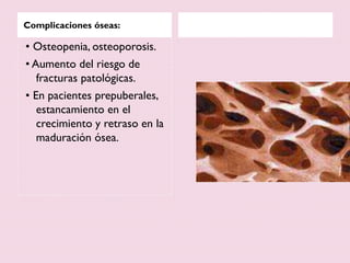 Complicaciones óseas:
• Osteopenia, osteoporosis.
• Aumento del riesgo de
fracturas patológicas.
• En pacientes prepuberales,
estancamiento en el
crecimiento y retraso en la
maduración ósea.
 