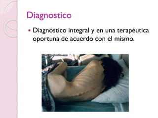 Diagnostico
 Diagnóstico integral y en una terapéutica
oportuna de acuerdo con el mismo.
 