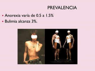 PREVALENCIA
 Anorexia varía de 0.5 a 1.5%
 Bulimia alcanza 3%.
 