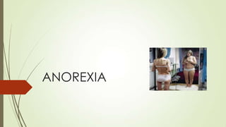 ANOREXIA
 