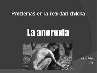 Problemas en la realidad chilena
La anorexia
Alicia Arias
2°B
 