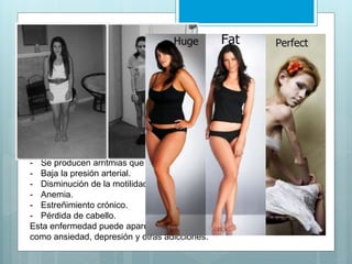 Síntomas de la Anorexia: 
Los síntomas más notorios son el rechazo a la comida y la insatisfacción con el 
propio cuerpo. Hacen una dieta muy estricta y están obsesionados por su 
apariencia. Tienen muy bajo peso y pueden a su vez obsesionarse con la actividad 
física. En el caso de las mujeres, otro síntoma, es la falta de menstruación o incluso 
la infertilidad, también se da la utilización de trampas para evitar la comida y la 
hiperactividad 
Físicamente puede observarse: 
- Uñas y cabello frágil y fino 
- Piel seca y amarillenta 
- Tono muscular débil 
- Cansancio 
- Las pulsaciones cardiacas se reducen. 
- Se producen arritmias que pueden derivar en un paro cardiaco. 
- Baja la presión arterial. 
- Disminución de la motilidad intestinal. 
- Anemia. 
- Estreñimiento crónico. 
- Pérdida de cabello. 
Esta enfermedad puede aparecer acompañada por otros desórdenes, 
como ansiedad, depresión y otras adicciones. 
 