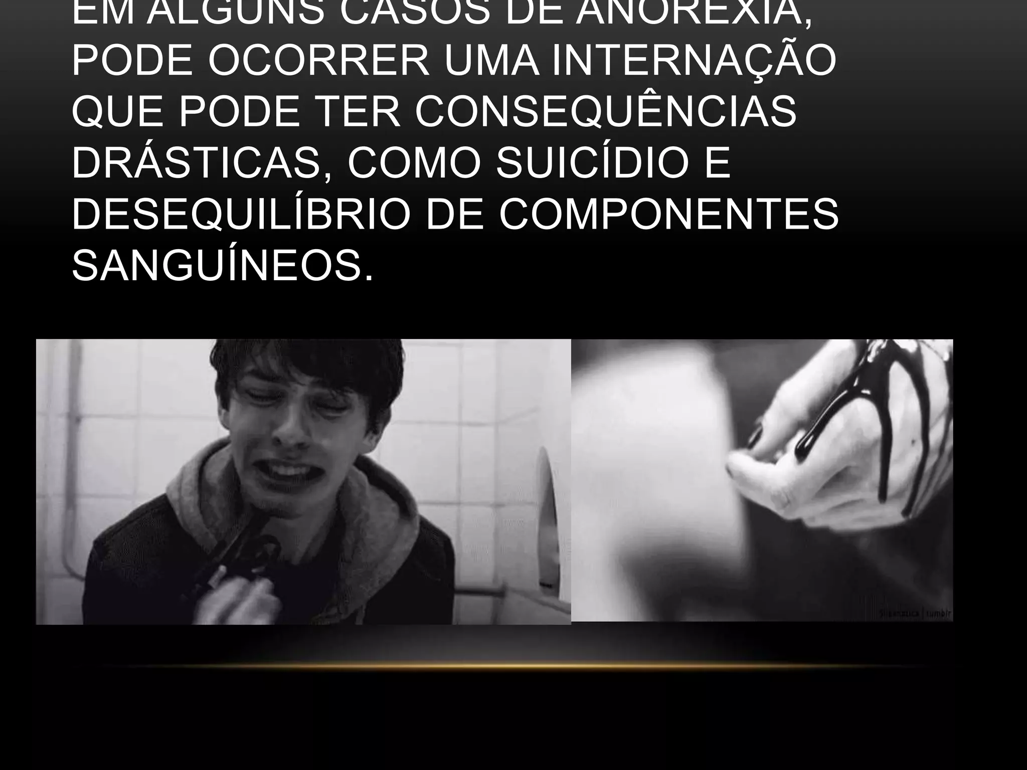 EM ALGUNS CASOS DE ANOREXIA, 
PODE OCORRER UMA INTERNAÇÃO 
QUE PODE TER CONSEQUÊNCIAS 
DRÁSTICAS, COMO SUICÍDIO E 
DESEQUILÍBRIO DE COMPONENTES 
SANGUÍNEOS. 
 