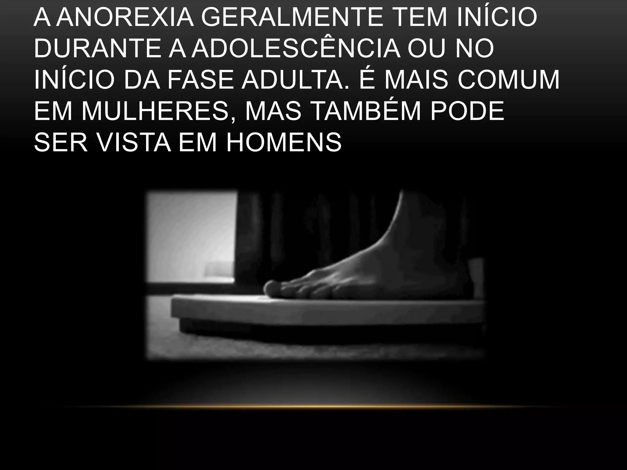 A ANOREXIA GERALMENTE TEM INÍCIO 
DURANTE A ADOLESCÊNCIA OU NO 
INÍCIO DA FASE ADULTA. É MAIS COMUM 
EM MULHERES, MAS TAMBÉM PODE 
SER VISTA EM HOMENS 
 