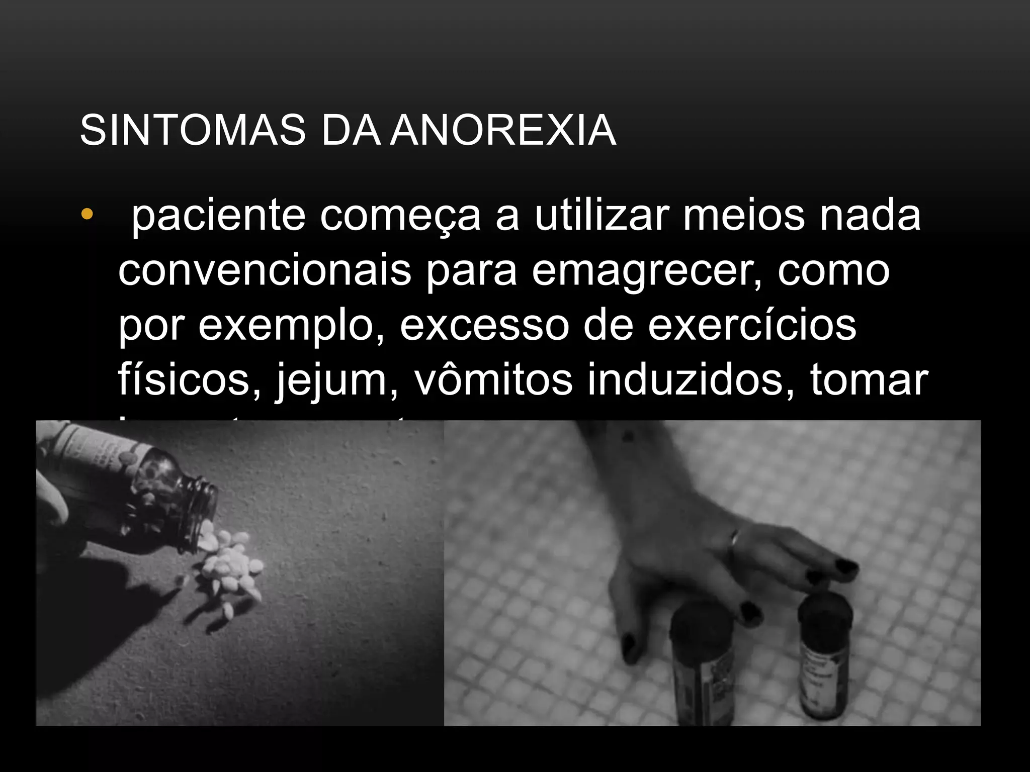 SINTOMAS DA ANOREXIA 
• paciente começa a utilizar meios nada 
convencionais para emagrecer, como 
por exemplo, excesso de exercícios 
físicos, jejum, vômitos induzidos, tomar 
laxantes e outros. 
 