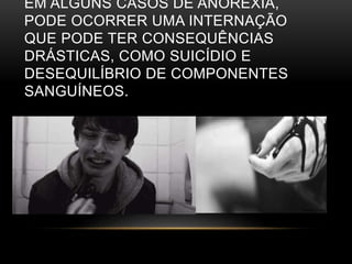 EM ALGUNS CASOS DE ANOREXIA, 
PODE OCORRER UMA INTERNAÇÃO 
QUE PODE TER CONSEQUÊNCIAS 
DRÁSTICAS, COMO SUICÍDIO E 
DESEQUILÍBRIO DE COMPONENTES 
SANGUÍNEOS. 
 