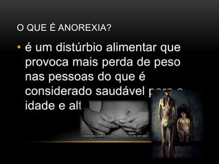 O QUE É ANOREXIA? 
• é um distúrbio alimentar que 
provoca mais perda de peso 
nas pessoas do que é 
considerado saudável para a 
idade e altura. 
 