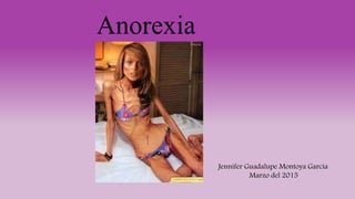 Anorexia
Jennifer Guadalupe Montoya García
Marzo del 2015
 