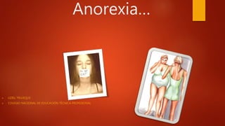 Anorexia…
 UZIEL TRUJEQUE
 COLEGIO NACIONAL DE EDUCACIÓN TÉCNICA PROFESIONAL
 