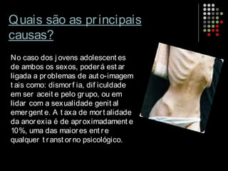 Quais são as principais
causas?
No caso dos j ovens adolescent es
de ambos os sexos, poderá est ar
ligada a problemas de aut o-imagem
t ais como: dismorf ia, dif iculdade
em ser aceit e pelo grupo, ou em
lidar com a sexualidade genit al
emergent e. A t axa de mort alidade
da anorexia é de aproximadament e
10%, uma das maiores ent re
qualquer t ranst orno psicológico.
 