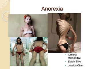 Anorexia
 Ximena
Hernández
 Edwin Silva
 Jessica Chan
 