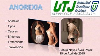 • Anorexia
• Tipos
• Causas
• Síntomas
• Tratamiento
• prevención
Sahira Nayeli Ávila Pérez
15 de Abril de 2015
 