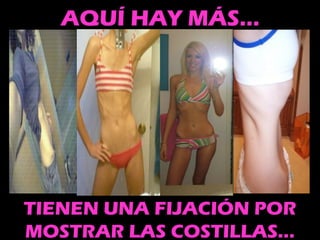 13
AQUÍ HAY MÁS…
TIENEN UNA FIJACIÓN POR
MOSTRAR LAS COSTILLAS…
 