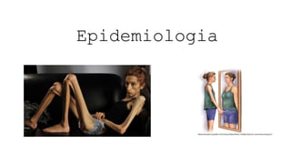 Epidemiologia
 
